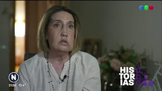 Carmen, from a DEADLY BACTERIA to undergoing a FACE TRANSPLANT - Unique stories on #TelefeNoticias