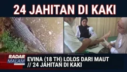 18-Year-Old Girl Attacked by Crocodile While Doing Laundry