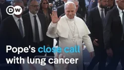 What we know about Pope Leo's cancer diagnosis after part of lung removed | DW News