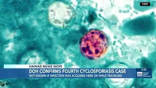 State confirms 4th case of cyclosporiasis in Hawaii-based military member