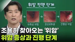 김형일 위장관외과 교수, 조용히 찾아오는 ‘위암’ [아침마당] | KBS 261015 방송