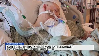 Kansas man battling cancer has life saved by CAR T-cell therapy