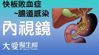 【大愛醫生館】 快板敗血症~膽道感染 20260917