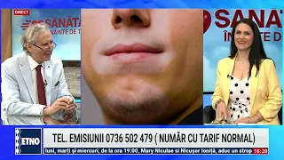 Vitiligo. Health Above All July 6, 2026. Gen. Prof. Dr. Ioan Nedelcu, Dermatologist