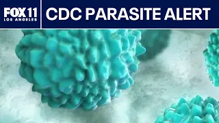 CDC investigates severe diarrhea parasite outbreak in 17 states