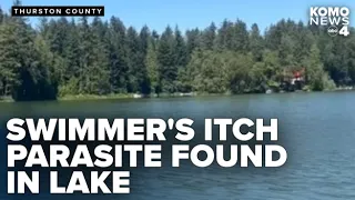 Thurston County health officials issue warning after swimmer’s itch reported at Clear Lake