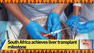 South Africa achieves liver transplant milestone