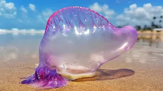 Portuguese man o' war on Spain's coast: How to react if you are stung