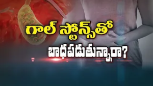 గాల్ స్టోన్స్ తో బాధపడుతున్నారా ? | Are you suffering with gall stones ? | Sukhibhava | ETV Life