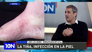 SKIN INFECTION 👨‍⚕