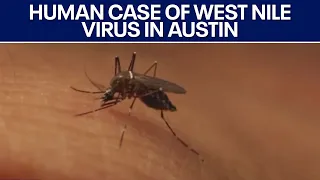 Travis County has first human case of West Nile virus of 2026 | FOX 7 Austin