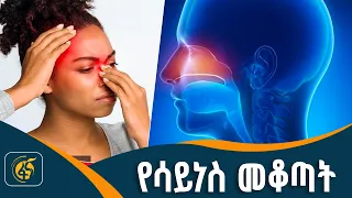 የአፍንጫ አለርጂና ሳይነስ ልዩነቱ ምንድን ነው?