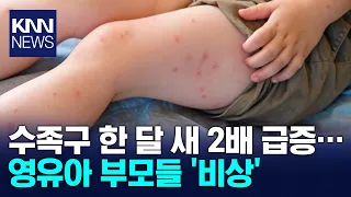 "Don't ignore blisters on hands and feet": Parents on high alert as hand, foot, and mouth disease...