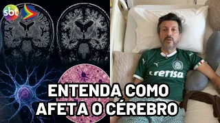 Lito Sousa: entenda como doença grave afeta o cérebro e evolui rapidamente