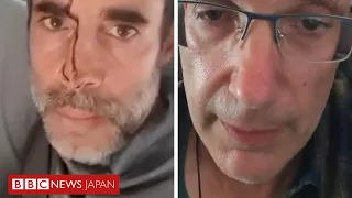 乗客が状況を説明、イスラエル行き旅客機での刺傷事件