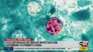 Cyclosporiasis outbreak investigation expanding to Pennsylvania