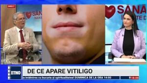 Gen Prof Dr Ioan Nedelcu   medic primar dermatolog - Cum tratezi vitiligo