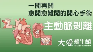 【大愛醫生館】 一開再開 愈開愈難開的開心手術 20260929