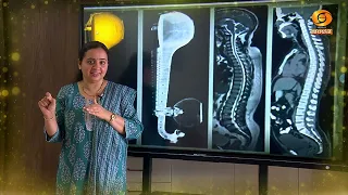 SCIENCE MAGAZINE | Vijnana Vismaya | Watch on 02.10.2026 @6.30pm on DD Chandana | PROMO