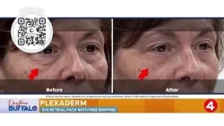 Daytime Buffalo: Plexaderm | Sponsored Segment