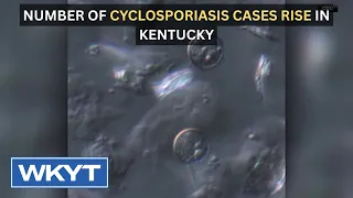 Number of cyclosporiasis cases rise in Kentucky