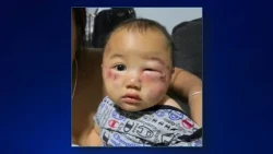 Baby boy badly injured at Tamuning daycare, mom and grandmother speak out