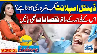 Dental Implant Risks & Side Effects | When Is an Implant Necessary? | Jagoo Lahore