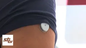 SBTV - DNEVNIK - TRUDNICAMA S DIJABETESEOM OMOGUĆENI BESPLATNI SENZORI - 04.02.2026.