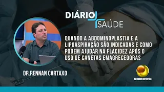 Quando a abdominoplastia e a lipoaspiração são indicadas e como podem ajudar na flacidez