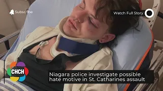 Niagara police investigate possible hate motive in St. Catharines assault