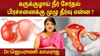 கருக்குழாய் நீர் சேர்தல் பிரச்சனைக்கு முழு தீர்வு என்ன ? | Dr.Jeyarani Kamaraj |