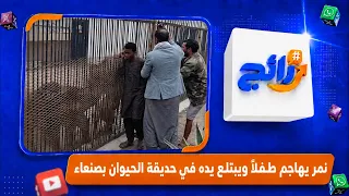 Tiger attacks a child and severs his hand at the Sana'a Zoo