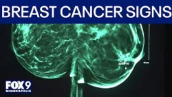 Beyond the Pink: Knowing the symptoms and warning signs of breast cancer