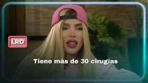 ‘La Barbie colombiana’ se cambió color de los ojos permanentemente - La Red | Caracol Televisión