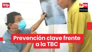 Especialista del Minsa explica síntomas, riesgos y prevención de la tuberculosis en el país