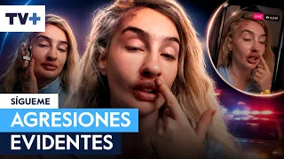 Fran Maira shows her face and makes it clear she cannot talk about it