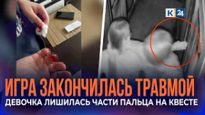 В Краснодаре девочка лишилась части пальца во время прохождения квеста