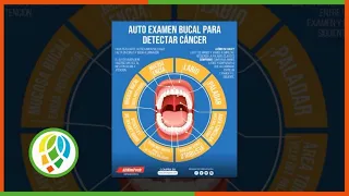 Cuba enfrenta el desafío del cáncer bucal con conciencia y hábitos saludables