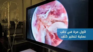 إجراء عملية تنظير كتف لأول مرة في مشفى  حلب الجامعي