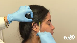 BOTOX HELPS CONTROL MIGRAINES | TVE REVISTA 08/19/2026