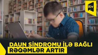 Daun sindromu ilə bağlı rəqəmlər artır: risklər və erkən diaqnostika