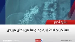 214 needles and pins were extracted from a patient's abdomen.