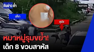นาทีสยอง! ฝูงหมาจรรุมขย้ำ เจ็บสาหัสกลางเคหะฯ | ทันข่าวค่ำ