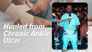 ИЗЛЕЧИЛАСЬ ХРОНИЧЕСКАЯ ЯЗВА НА ЛОДЫЖКЕ