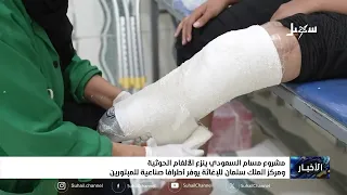 Saudi MASAM Project Clears Houthi Landmines and King Salman Relief Center Provides Prosthetic Lim...