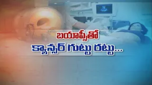 బయాప్సీతో క్యాన్సర్ గుట్టు రట్టు | Detect Cancer with Biopsy Test  | Sukhibhava | ETV Life