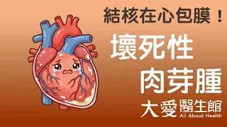 【大愛醫生館】 結核在心包膜！ 20260930