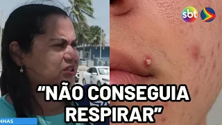 Jovem é internado na UTI após espremer espinha; mãe relata desespero-4k