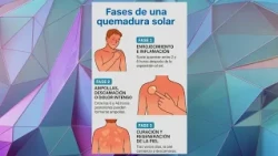 Skin Care When Exposed to the Sun