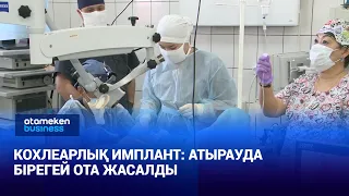 Кохлеарлық имплант: Атырауда бірегей ота жасалды